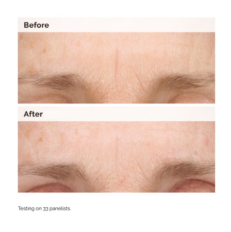 The Ordinary Retinal 0.2% Emulsion 15ml20